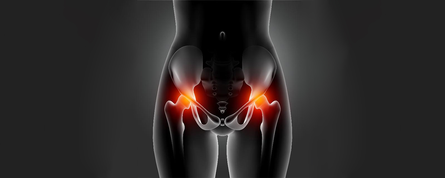 Lawsuit Filed Over Defective Biomet M2A Metal Hip Implants