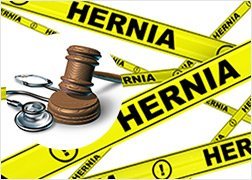 Ethicon Faces Defective Design Lawsuit For Its Hernia Mesh