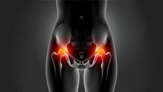 Lawsuit Filed Over Defective Biomet M2A Metal Hip Implants